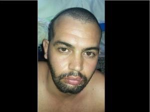 Migrante cubano se cose la boca