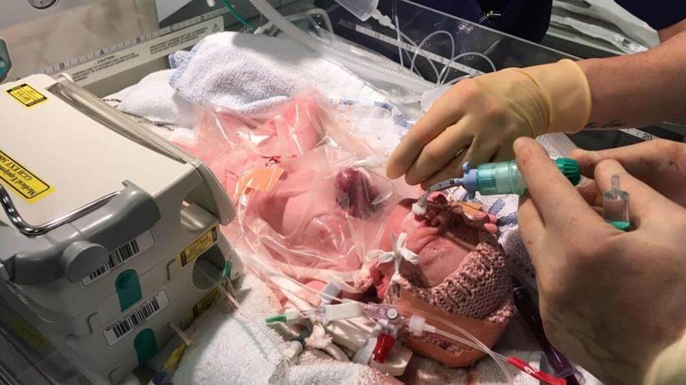 corazón fuera del cuerpo