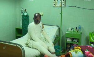 pacientes hospitalizados