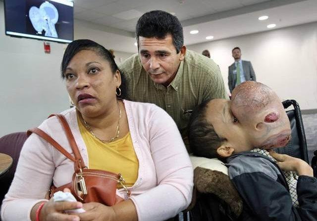 tumor facial