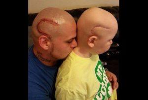 niño cuyo padre se tatuó una cicatriz como la suya