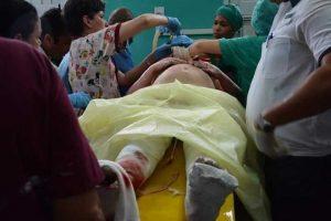 estado de salud de los sobrevivientes