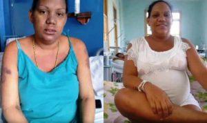 en un hospital cubano