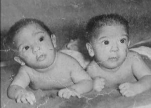 Las siamesas cubanas