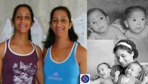 Las siamesas cubanas