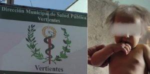 Síndrome de Alagille
